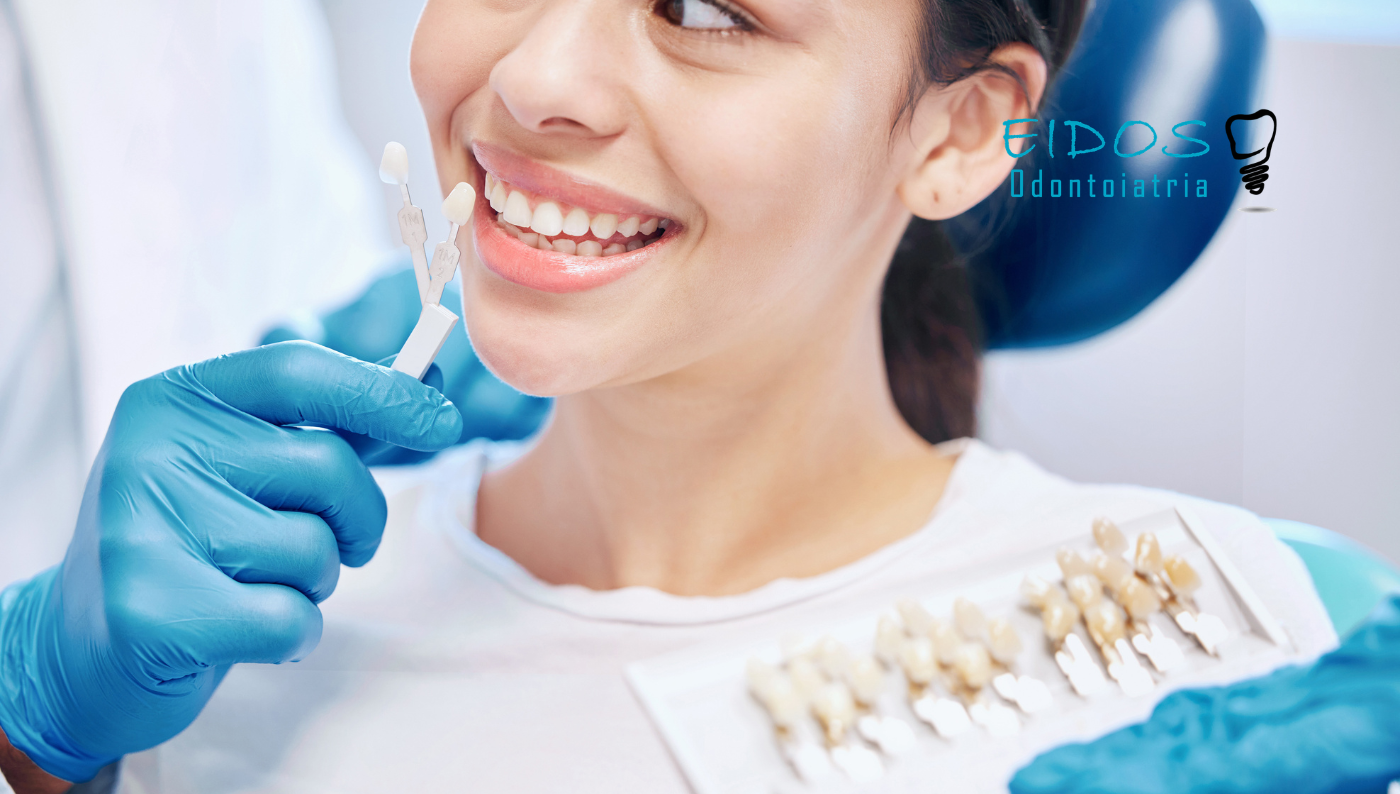 faccette mini invasive eidos