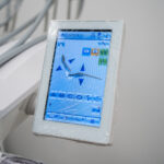 Denti fissi sì, ma senza fretta: una guida pratica all’implantologia